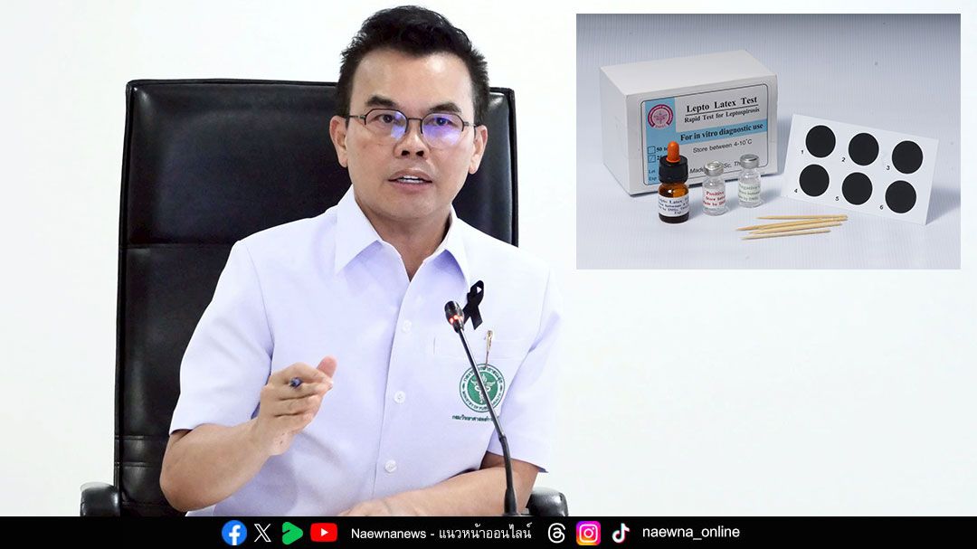 กรมวิทย์ฯ ห่วงประชาชนลุยน้ำท่วมเสี่ยงโรคฉี่หนู สนับสนุนชุดตรวจเบื้องต้น