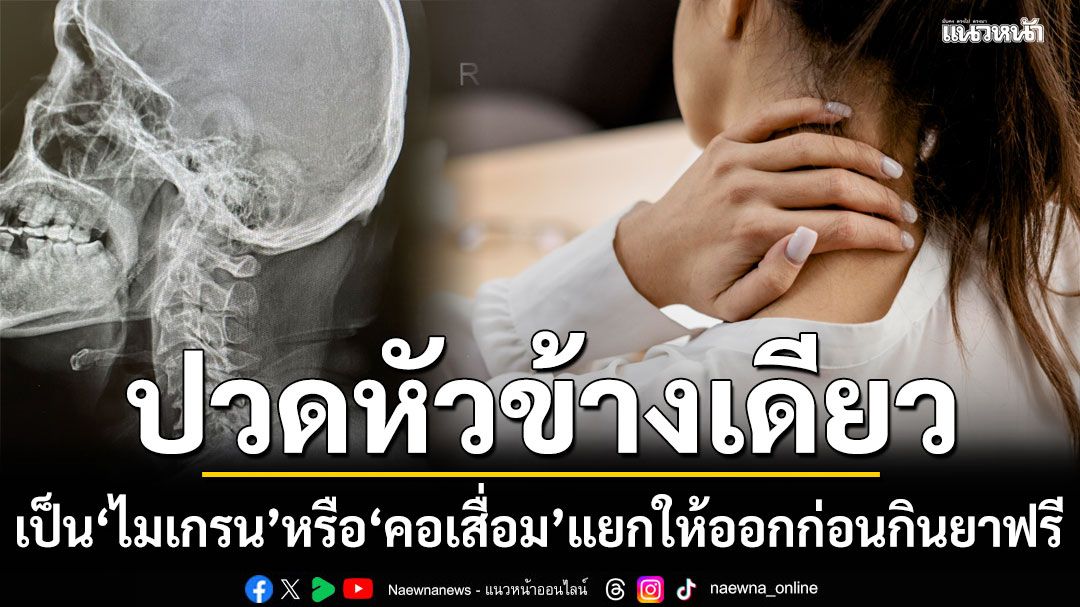 ปวดหัวข้างเดียว เป็น ไมเกรน หรือ คอเสื่อม แยกให้ออกก่อนกินยาฟรีมาเป็นปี