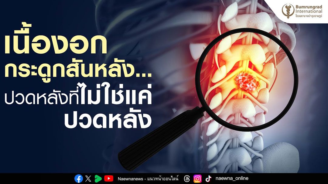 เนื้องอกกระดูกสันหลัง กับอาการปวดหลัง แค่ไม่ใช่ปวดหลัง