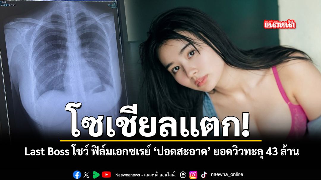 มากกว่าแค่ผลตรวจ เมื่อ Last Boss โชว์ฟิล์ม X ray ภาพเดียว 43 ล้านวิว ชมคลิป