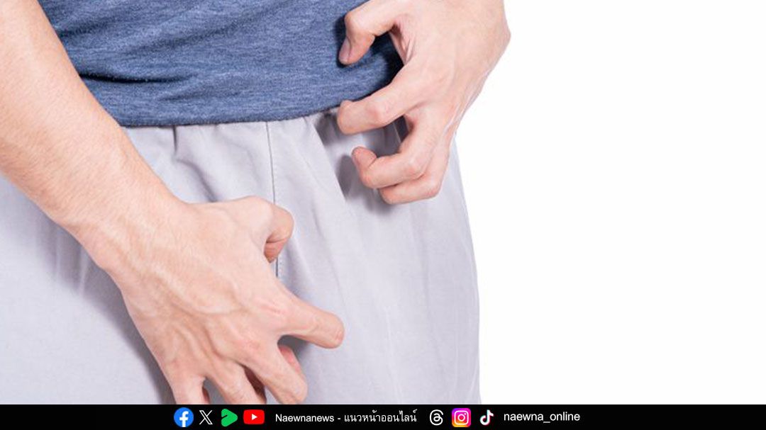 ประเทศไทยร่วมการทดลองทางคลินิก รับมือเชื้อดื้อยารักษาโรคหนองใน