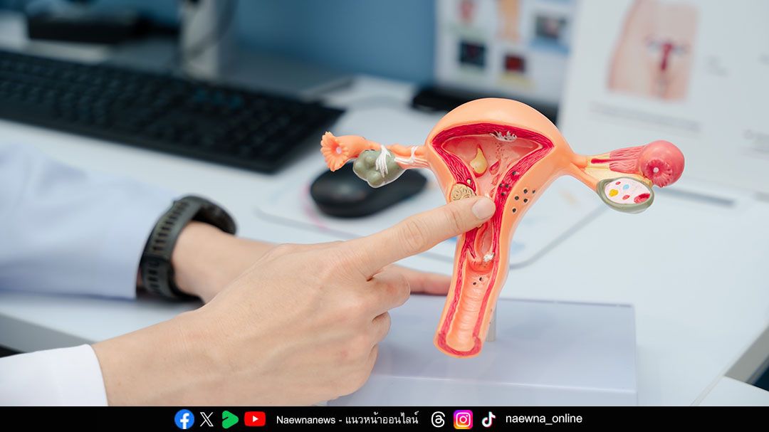 ผู้หญิงปัสสาวะเล็ด อาจไม่ใช่เรื่องเล็ก ภัยเงียบเสี่ยง ‘มดลูกหย่อน’