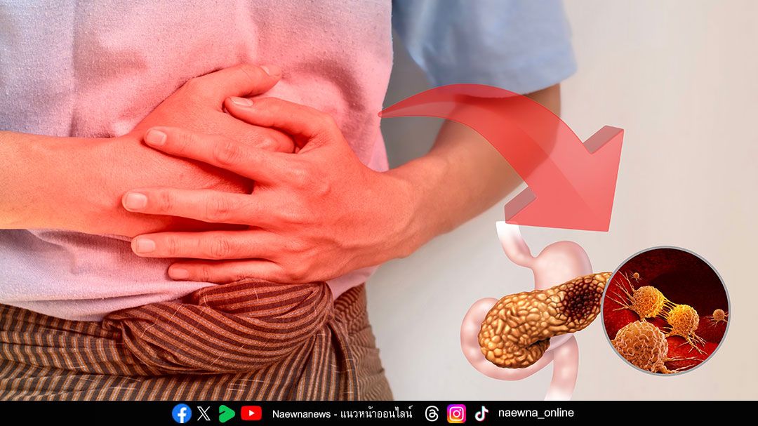 มะเร็งตับอ่อน ภัยเงียบที่คร่าชีวิตสูง เพราะรู้ตัวเมื่อสายเกินไป