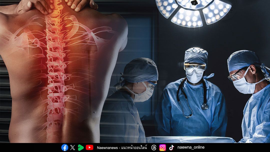 ผ่าตัดคืนเดียว ลดต้นทุนทั้งระบบ ‘MIS’ เขย่าโมเดลรักษากระดูกสันหลังไทย