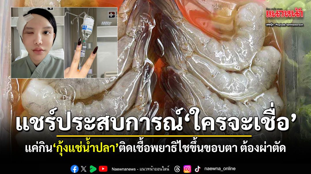 อุทาหรณ์สายดิบ สาวแชร์ประสบการณ์ กินกุ้งแช่น้ำปลา พยาธิลามถึงขอบตาจนต้องผ่าตัด