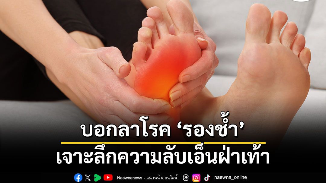 บอกลาโรค ‘รองช้ำ’ เจาะลึกความลับเอ็นฝ่าเท้า พร้อมนวัตกรรมรักษาให้หายขาด