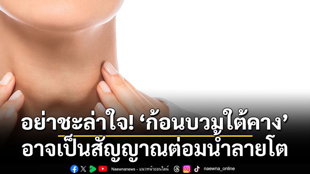 อย่าชะล่าใจ! ‘ก้อนบวมใต้คาง’ อาจเป็นสัญญาณต่อมน้ำลายโต