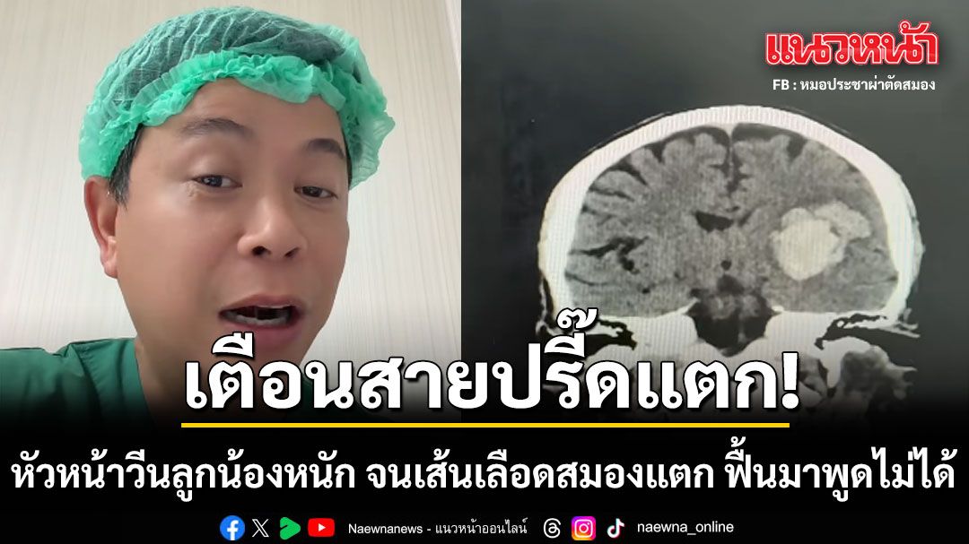 เตือนสายปรี๊ดแตก! หัวหน้าโมโห-วีนลูกน้องหนัก จนเส้นเลือดสมองแตก ฟื้นมาพูดไม่ได้