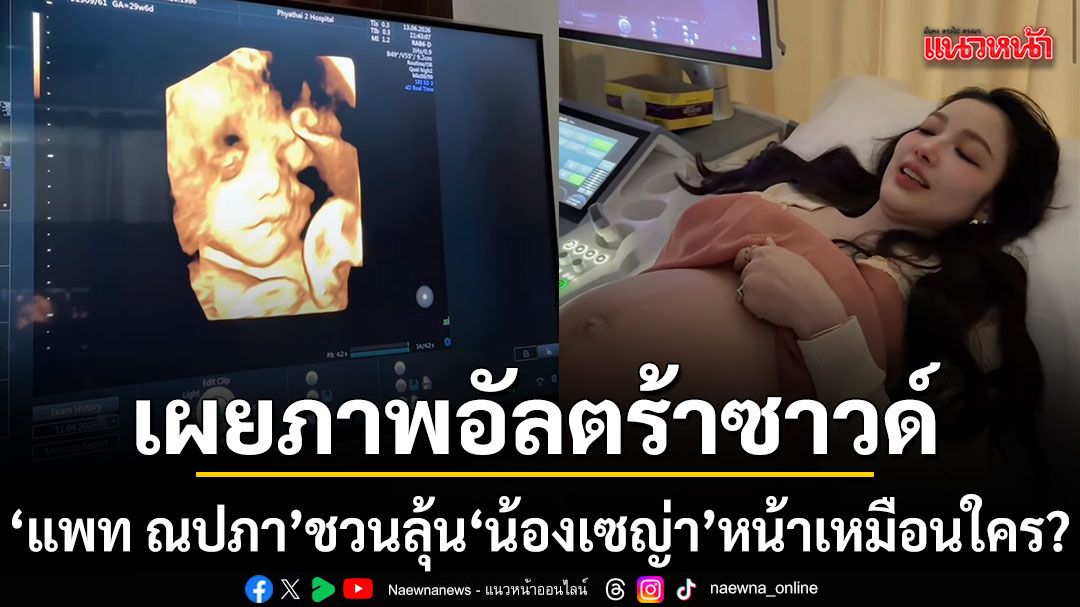 แพท ณปภา เผยภาพอัลตร้าซาวด์ 4 มิติ ชวนลุ้น น้องเซญ่า หน้าเหมือนใคร?