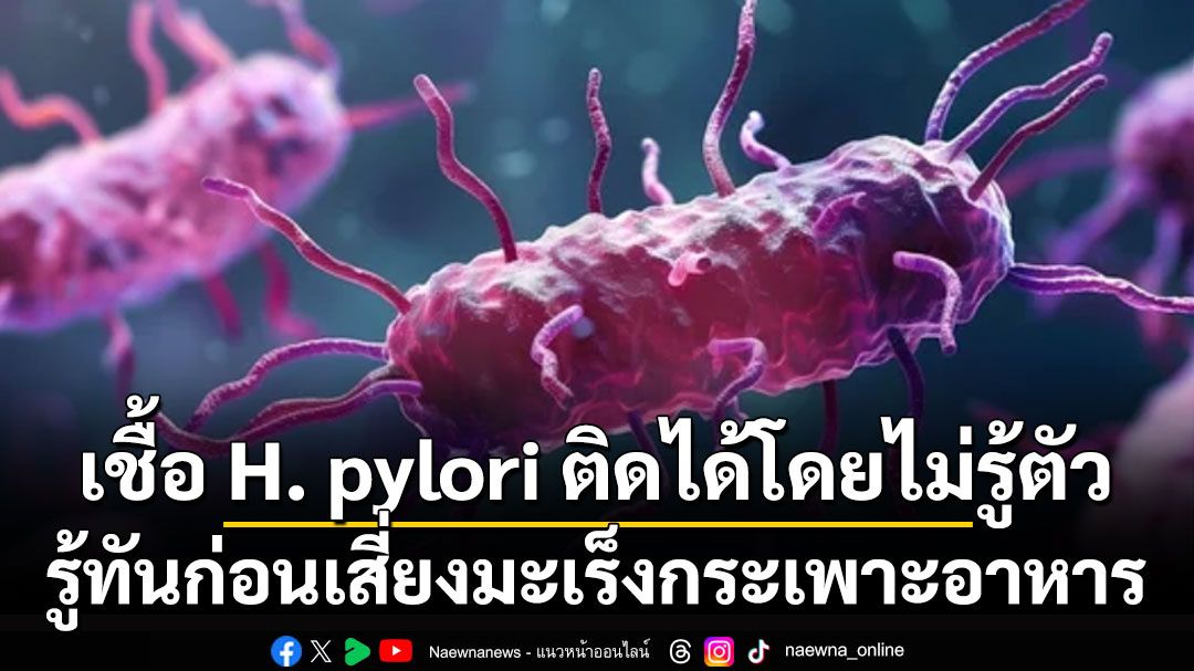 เชื้อ H. pylori ติดได้โดยไม่รู้ตัว รู้ทันก่อนเสี่ยงมะเร็งกระเพาะอาหาร