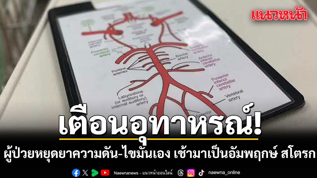 หมอยกเคส ลุง 58 เป็นความดัน-ไขมันสูง หยุดยาเอง เช้ามาเป็นอัมพฤกษ์ สโตรก ถามหาไม่ทันตั้งตัว